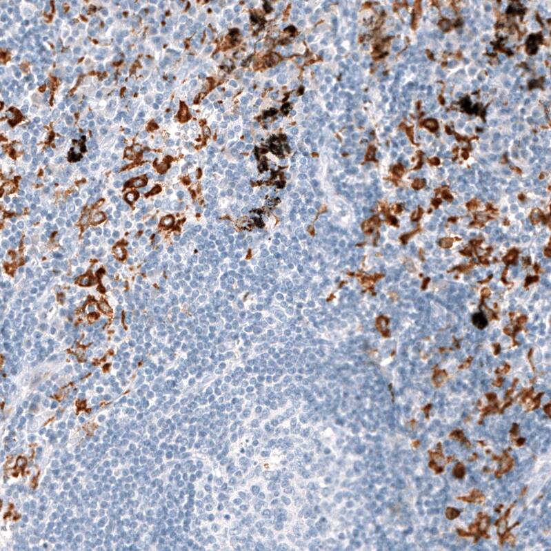 Immunohistochemistry-Paraffin: CD163 Antibody [NBP3-21179] -