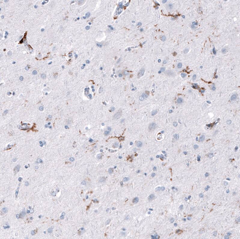 Immunohistochemistry-Paraffin: CD163 Antibody [NBP3-21179] -