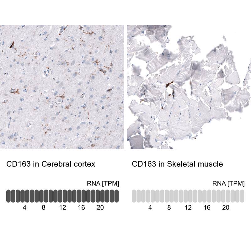 Immunohistochemistry-Paraffin: CD163 Antibody [NBP3-21179] -