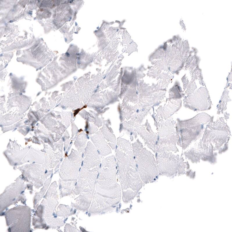 Immunohistochemistry-Paraffin: CD163 Antibody [NBP3-21179] -