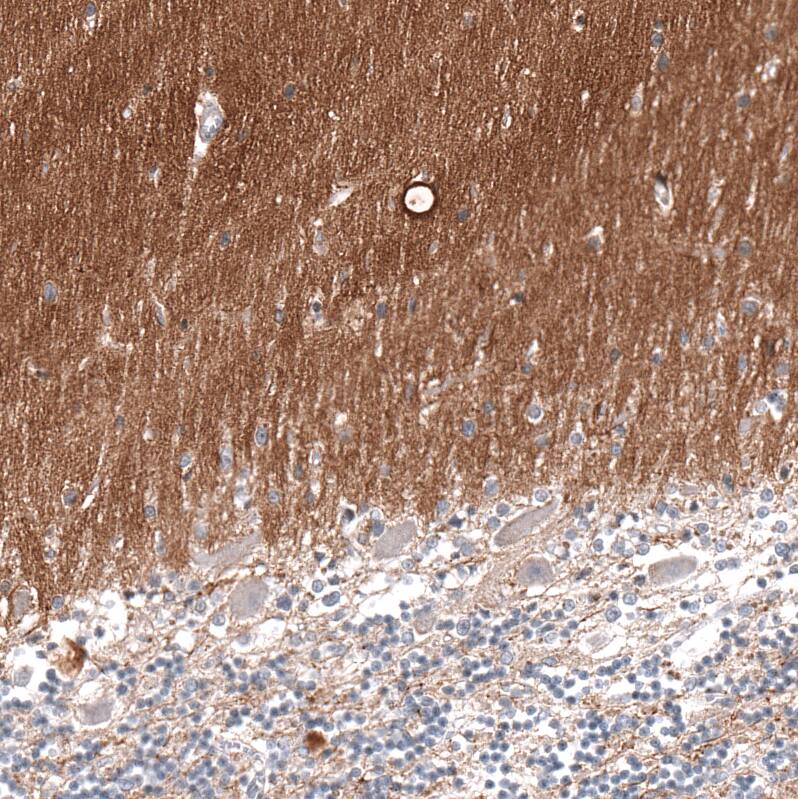GAP-43 Antibody (CL10847) - BSA Free Immunohistochemistry-Paraffin: GAP-43 Antibody [NBP3-21181] -