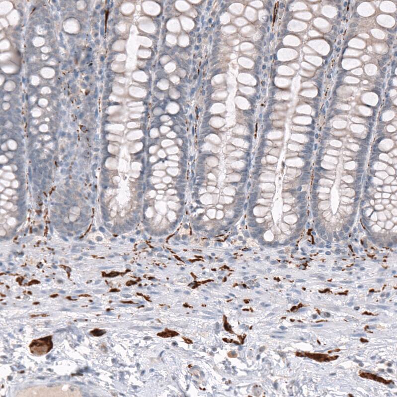 GAP-43 Antibody (CL10847) - BSA Free Immunohistochemistry-Paraffin: GAP-43 Antibody [NBP3-21181] -