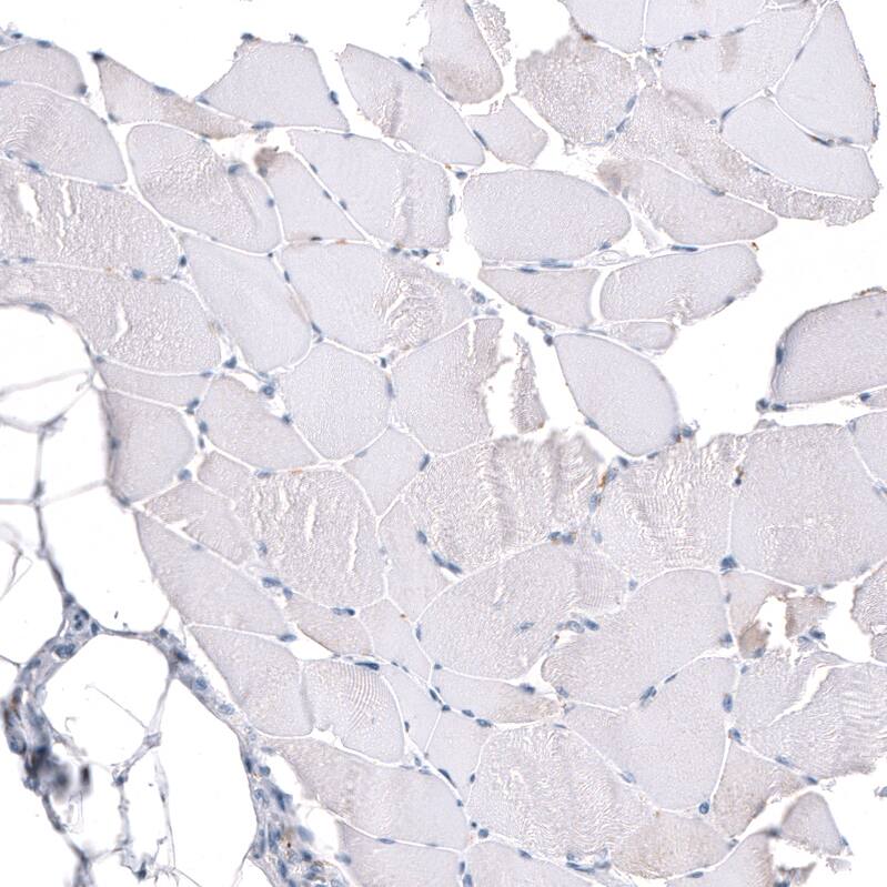 GAP-43 Antibody (CL10847) - BSA Free Immunohistochemistry-Paraffin: GAP-43 Antibody [NBP3-21181] -