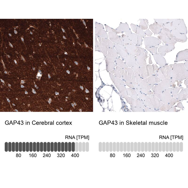 Immunohistochemistry-Paraffin: GAP-43 Antibody [NBP3-21181] -