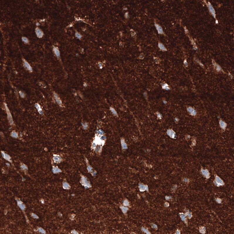 Immunohistochemistry-Paraffin: GAP-43 Antibody [NBP3-21181] -