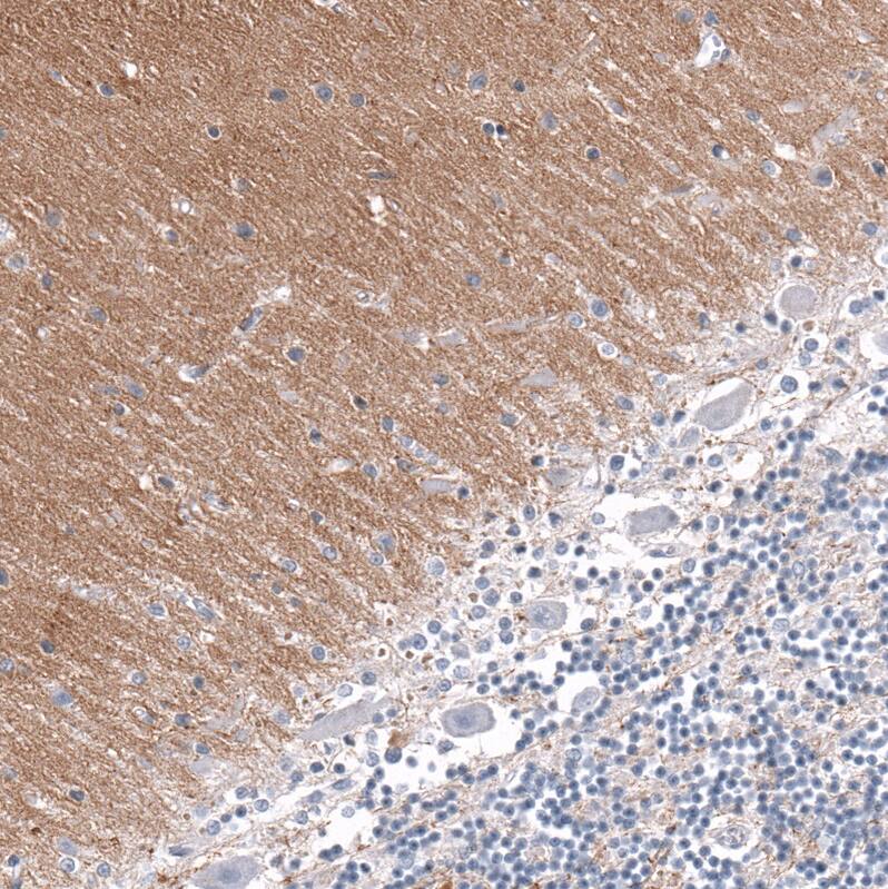 Immunohistochemistry-Paraffin: GAP-43 Antibody [NBP3-21182] -