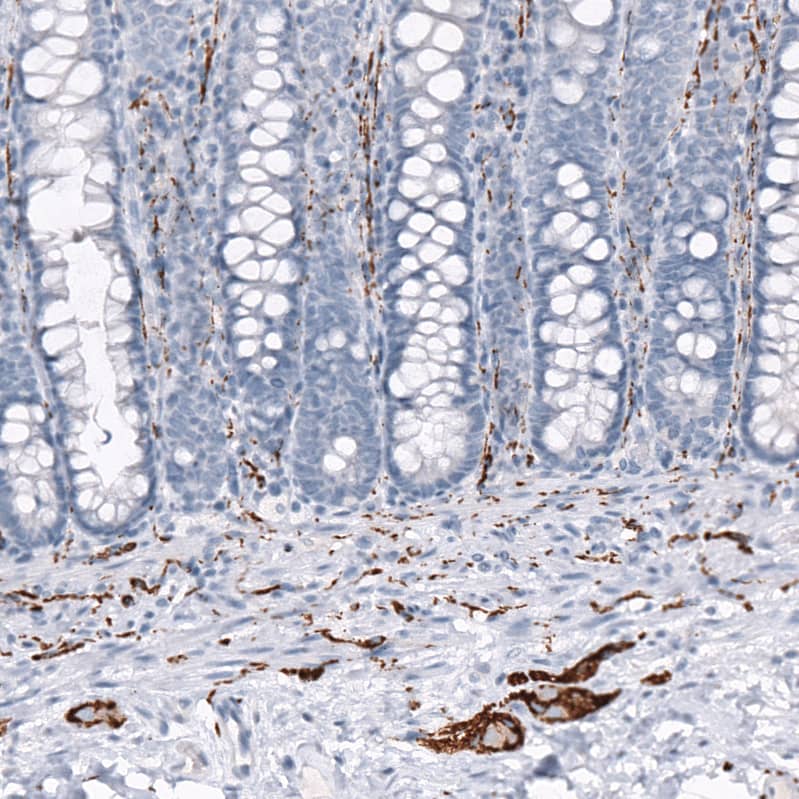 Immunohistochemistry-Paraffin: GAP-43 Antibody [NBP3-21182] -