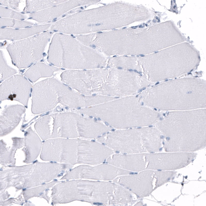 Immunohistochemistry-Paraffin: GAP-43 Antibody [NBP3-21182] -