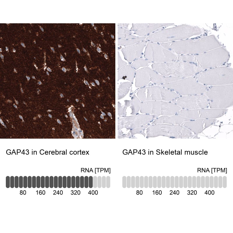 Immunohistochemistry-Paraffin: GAP-43 Antibody [NBP3-21182] -