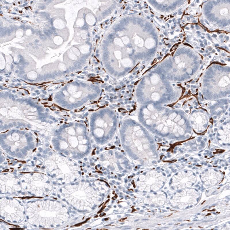 Immunohistochemistry-Paraffin: GAP-43 Antibody [NBP3-21183] -