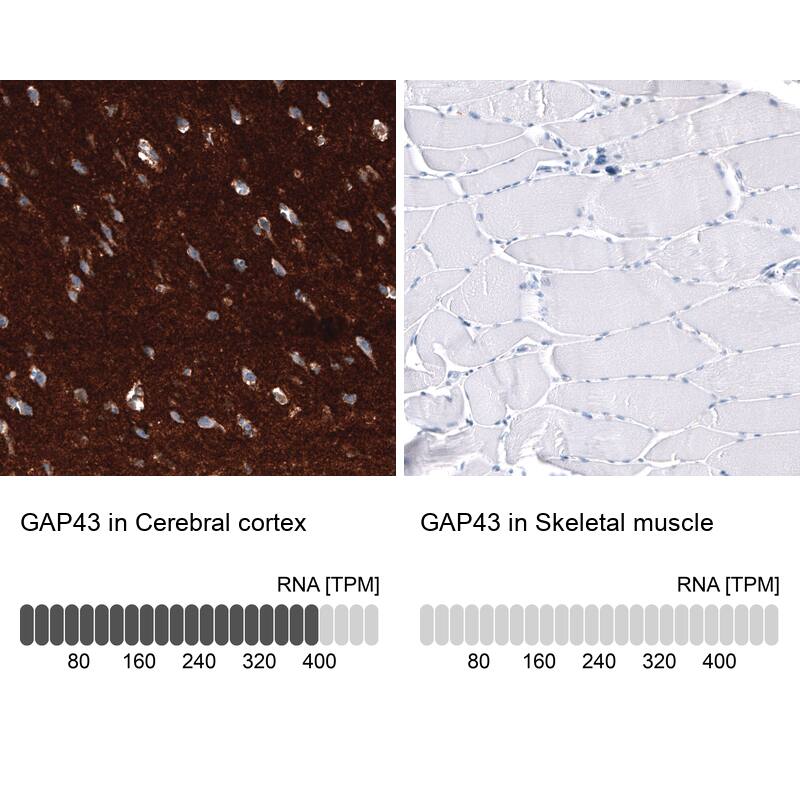 Immunohistochemistry-Paraffin: GAP-43 Antibody [NBP3-21183] -