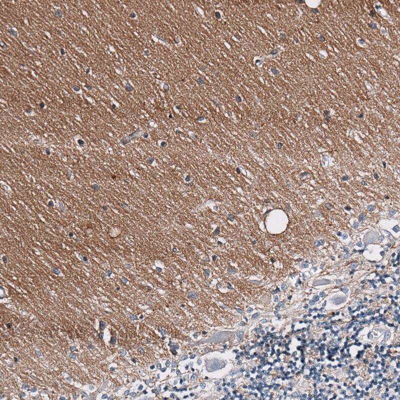 Immunohistochemistry-Paraffin: GAP-43 Antibody [NBP3-21183] -