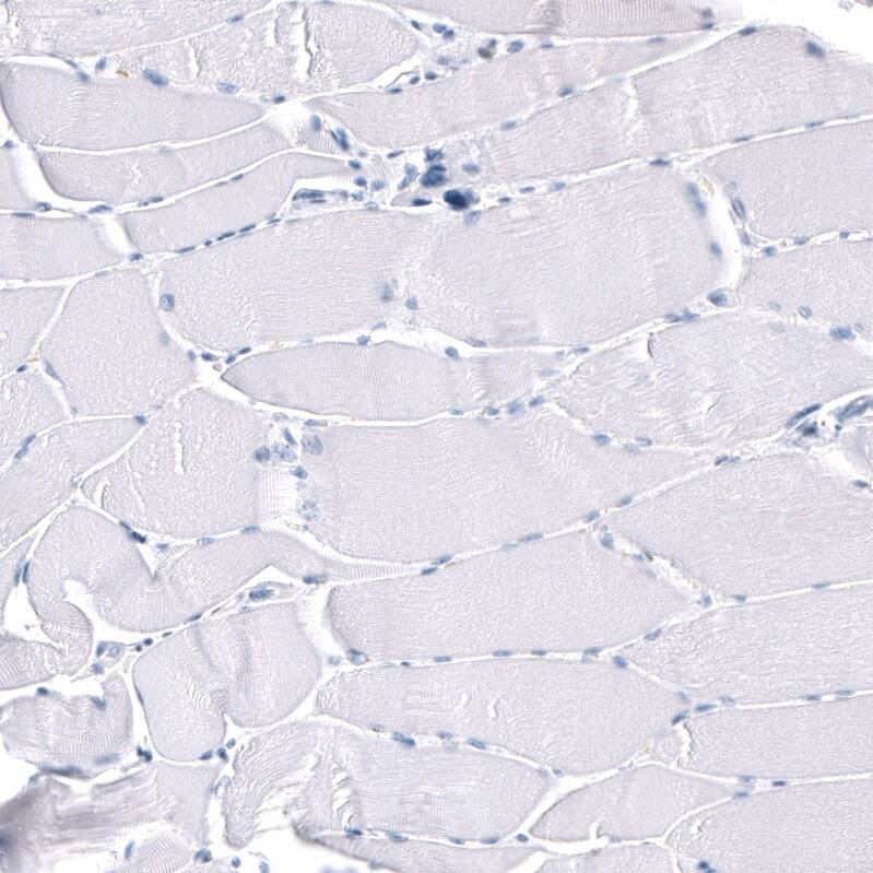 Immunohistochemistry-Paraffin: GAP-43 Antibody [NBP3-21183] -