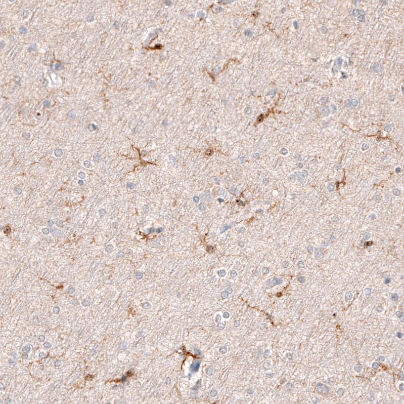 Immunohistochemistry-Paraffin: AIF-1/Iba1 Antibody [NBP3-21184] -