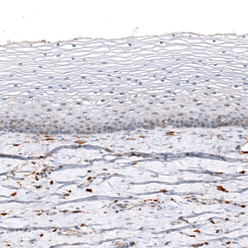 Immunohistochemistry-Paraffin: AIF-1/Iba1 Antibody [NBP3-21184] -