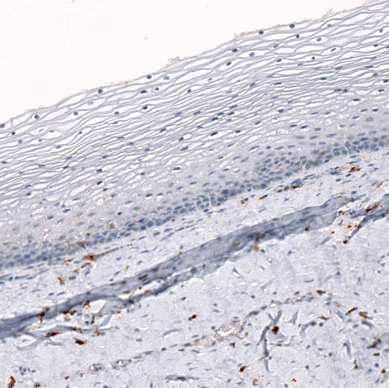 Immunohistochemistry-Paraffin: AIF-1/Iba1 Antibody [NBP3-21185] -