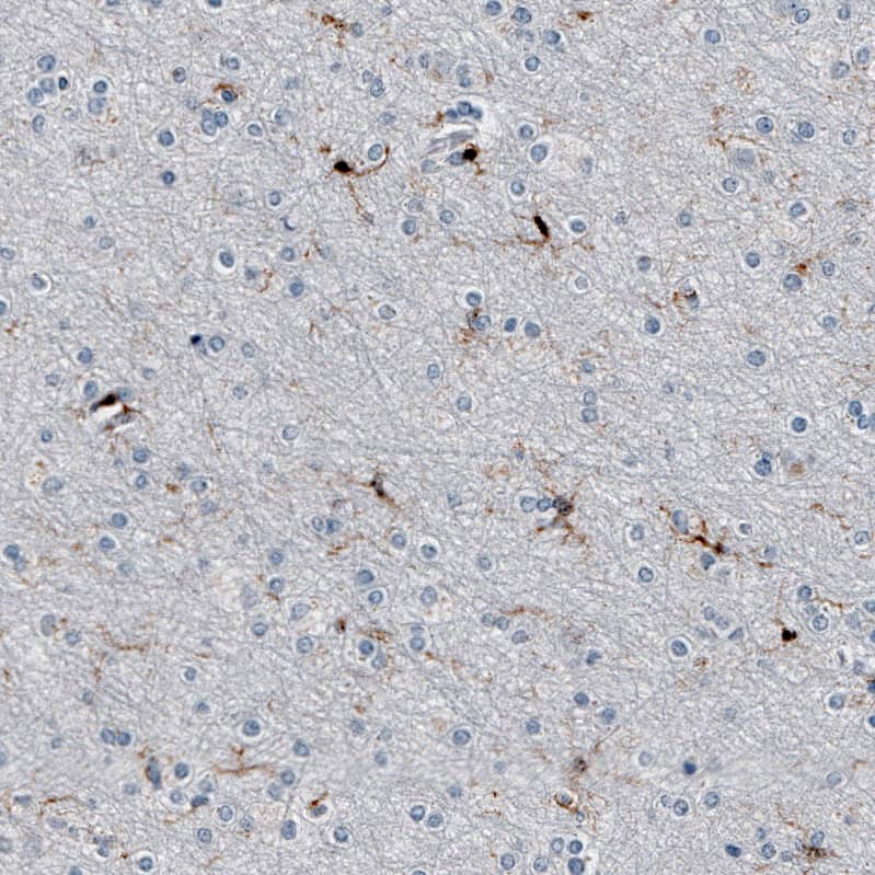Immunohistochemistry-Paraffin: AIF-1/Iba1 Antibody [NBP3-21185] -
