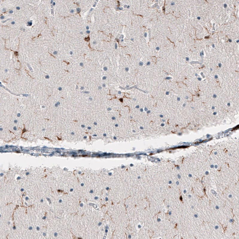 Immunohistochemistry-Paraffin: AIF-1/Iba1 Antibody [NBP3-21185] -