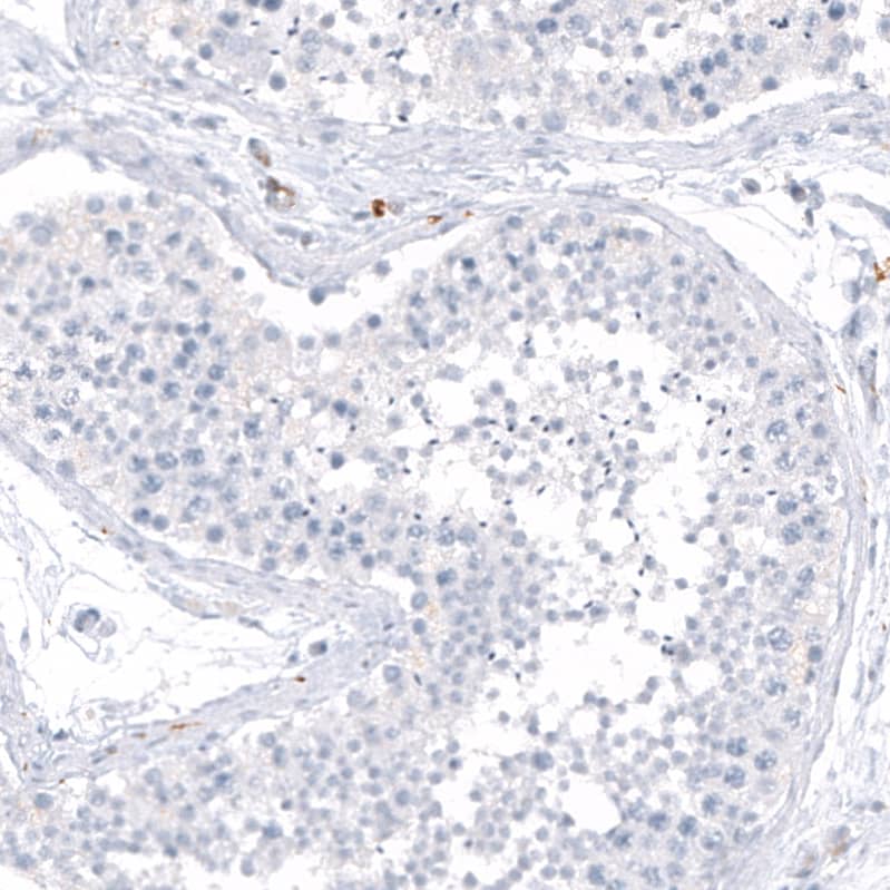 Immunohistochemistry-Paraffin: HLA DR/DP Antibody [NBP3-21186] -