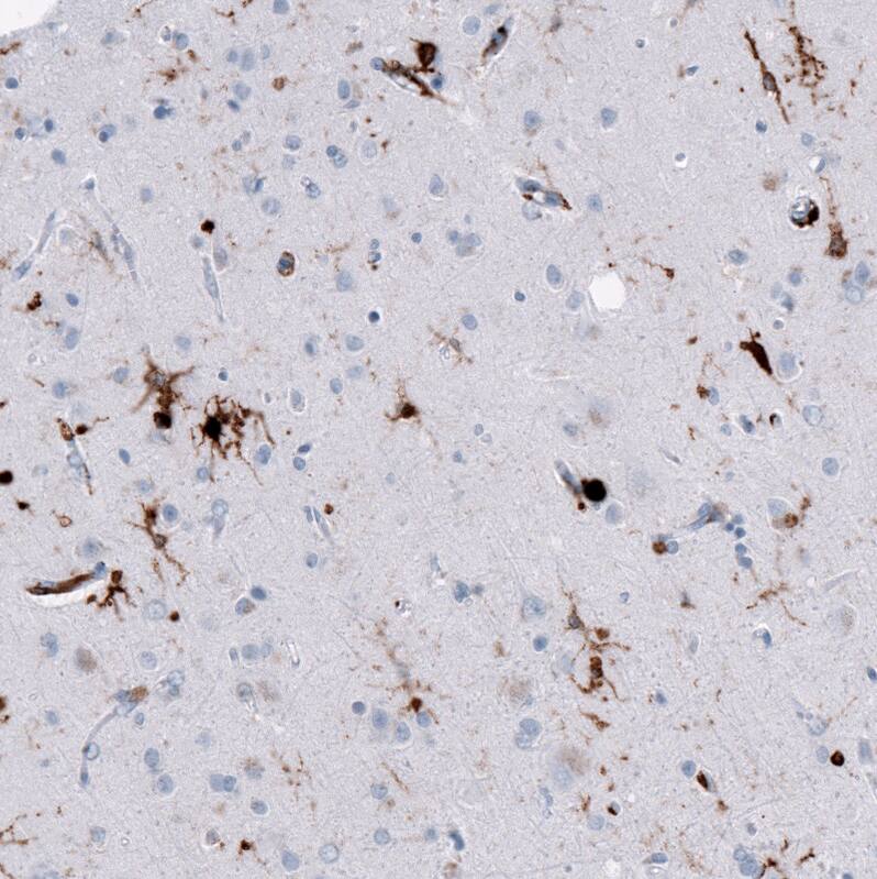 Immunohistochemistry-Paraffin: HLA DR/DP Antibody [NBP3-21186] -