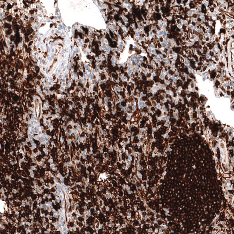 Immunohistochemistry-Paraffin: HLA DR/DP Antibody [NBP3-21187] -