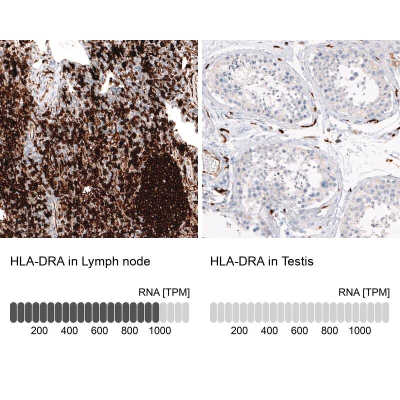 Immunohistochemistry-Paraffin: HLA DR/DP Antibody [NBP3-21187] -
