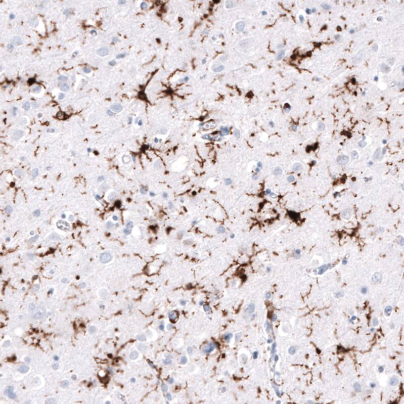 Immunohistochemistry-Paraffin: HLA DR/DP Antibody [NBP3-21187] -