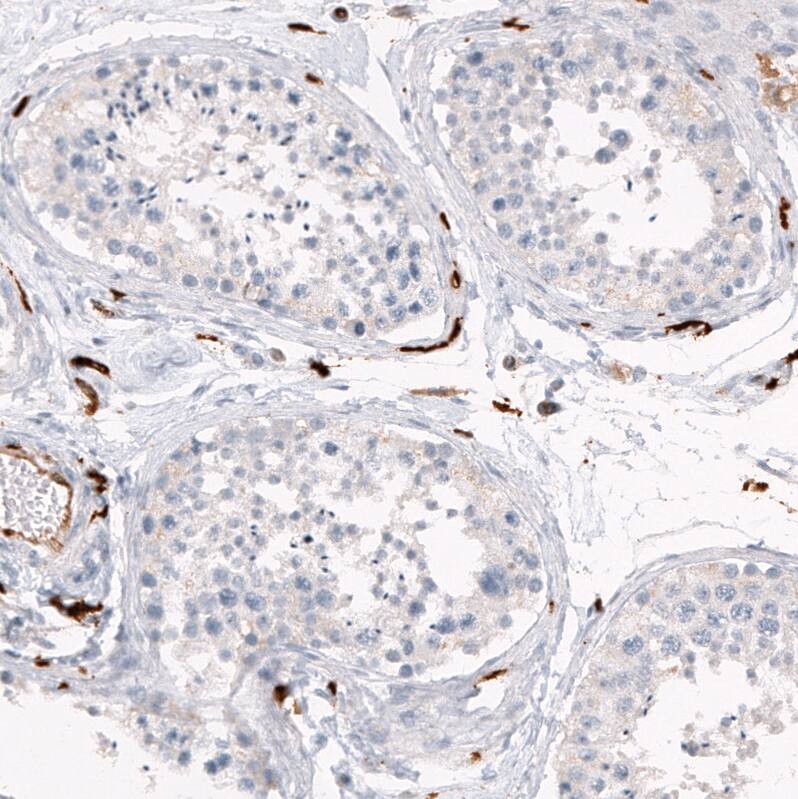 Immunohistochemistry-Paraffin: HLA DR/DP Antibody [NBP3-21187] -
