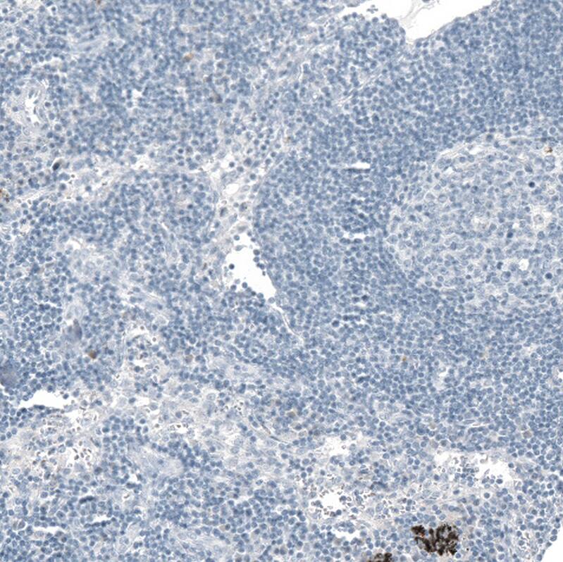 Immunohistochemistry-Paraffin: OTP Antibody [NBP3-21188] -