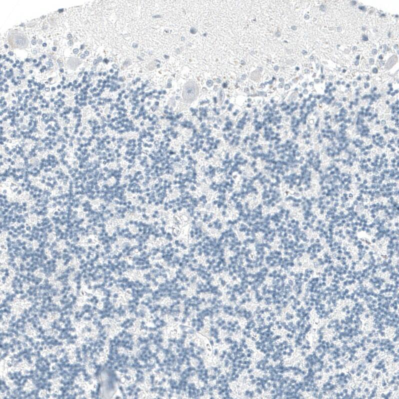 Immunohistochemistry-Paraffin: OTP Antibody [NBP3-21188] -
