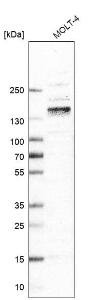 Western Blot: Integrin alpha 4 beta 7/LPAM-1 Antibody [NBP3-21189] -