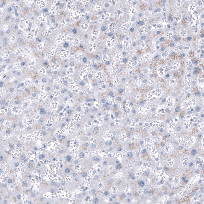 Immunohistochemistry-Paraffin: NKX2.2 Antibody [NBP3-21191] -