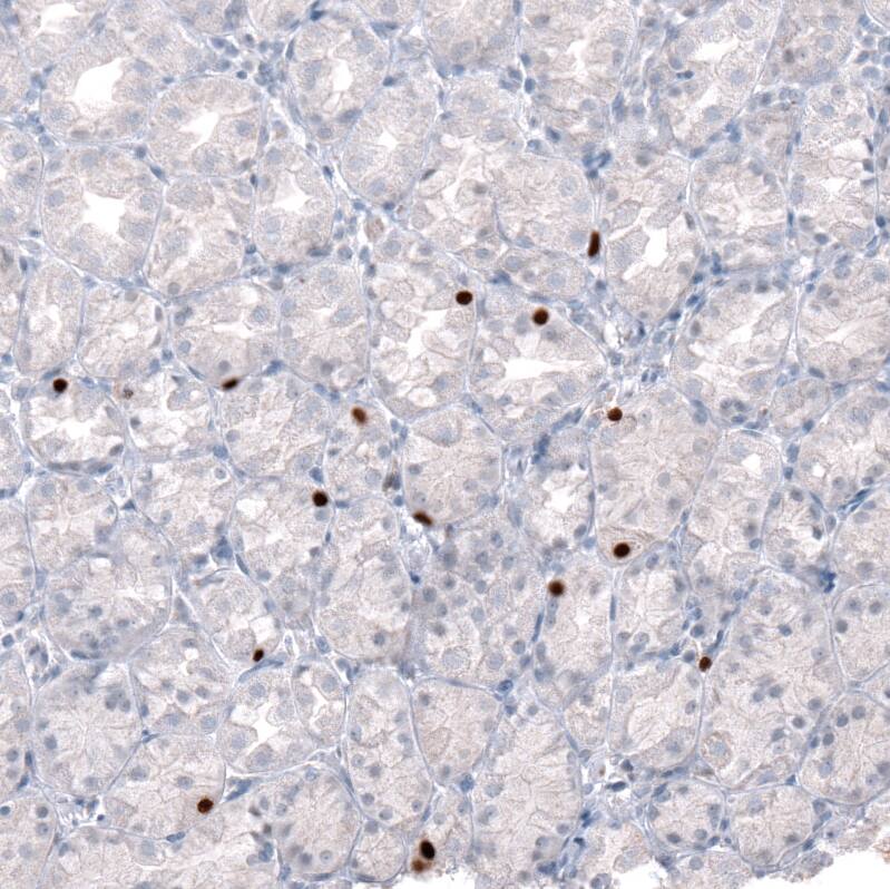 Immunohistochemistry-Paraffin: NKX2.2 Antibody [NBP3-21191] -