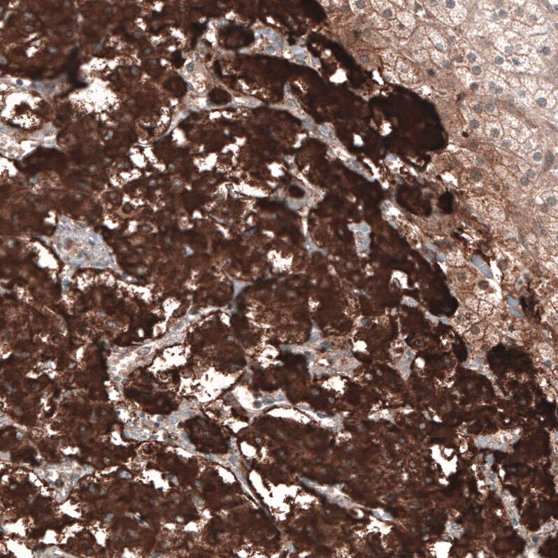 Immunohistochemistry-Paraffin: Chromogranin B Antibody [NBP3-21192] -