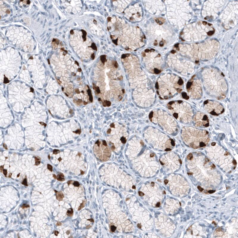 Immunohistochemistry-Paraffin: Chromogranin B Antibody [NBP3-21192] -