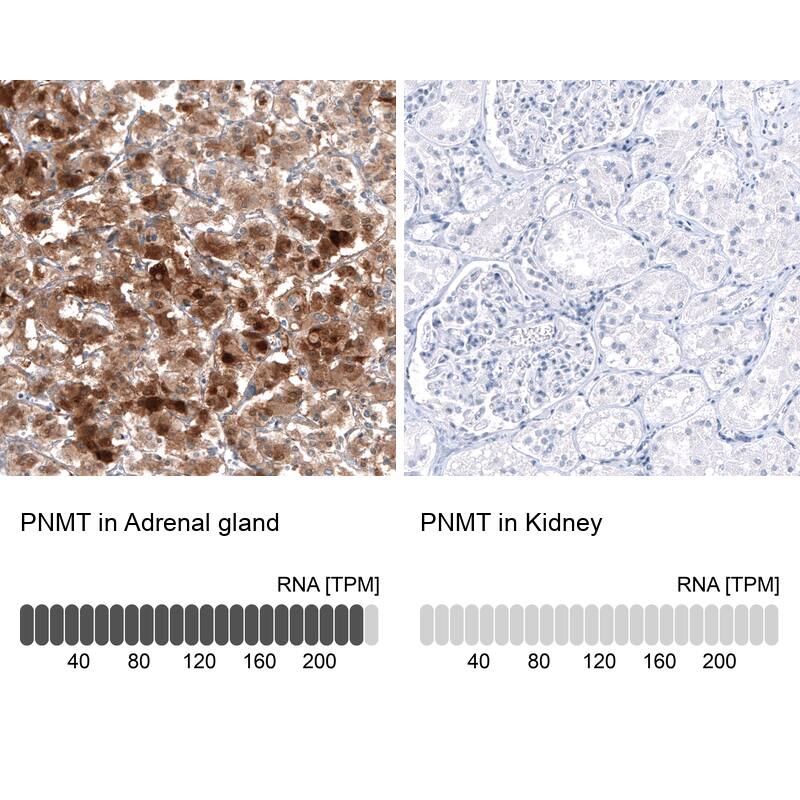 Immunohistochemistry-Paraffin: PNMT Antibody [NBP3-21193] -