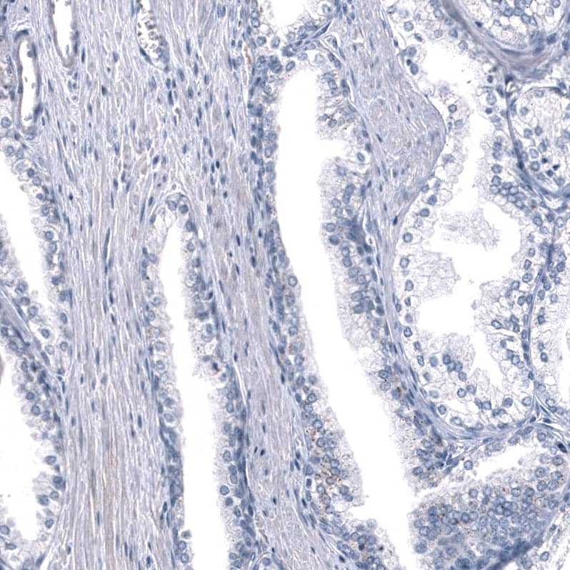 Immunohistochemistry-Paraffin: GPR97 Antibody [NBP3-21195] -