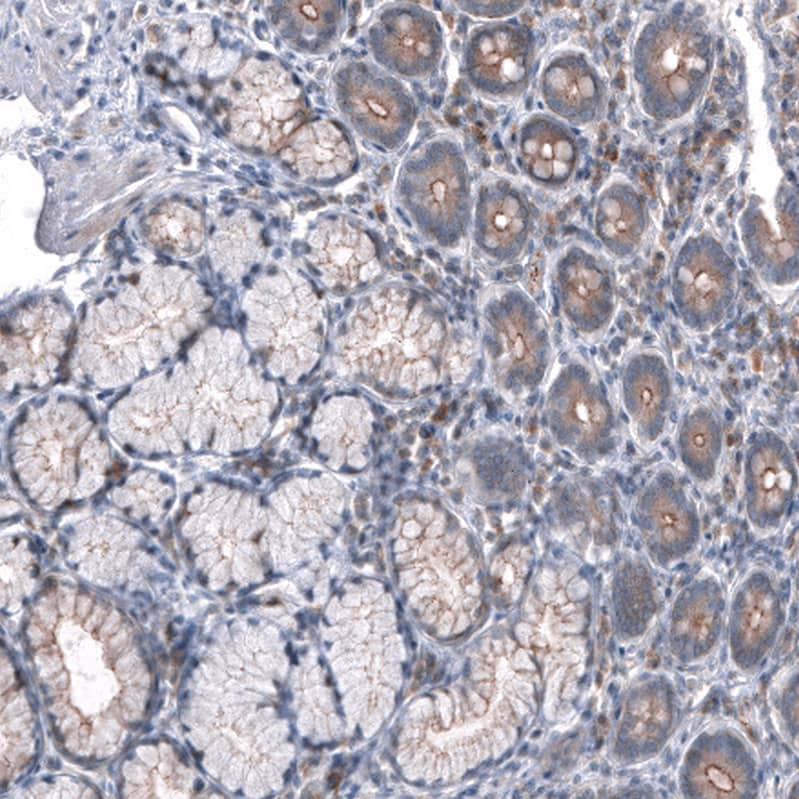 Immunohistochemistry-Paraffin: GPR97 Antibody [NBP3-21195] -