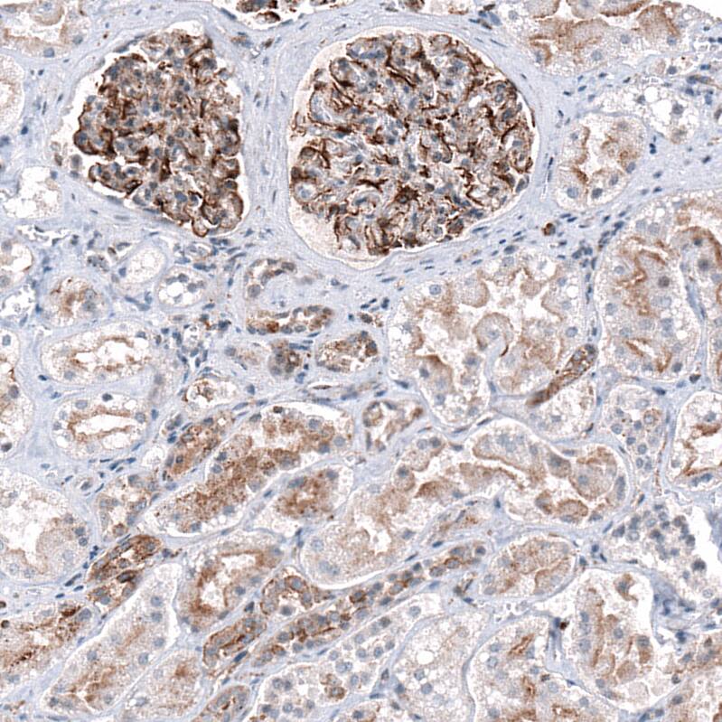 Immunohistochemistry-Paraffin: P2X7/P2RX7 Antibody [NBP3-21196] -