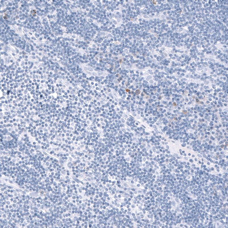 Immunohistochemistry-Paraffin: TCF7L2 Antibody [NBP3-21197] -