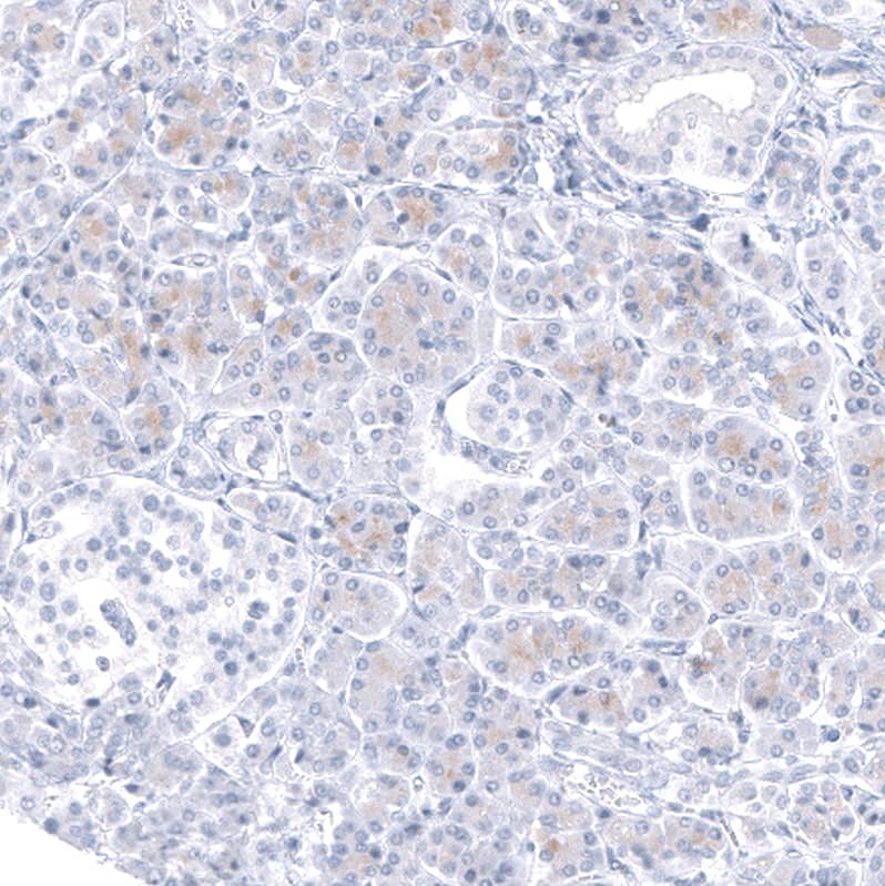 Immunohistochemistry-Paraffin: TCF7L2 Antibody [NBP3-21197] -