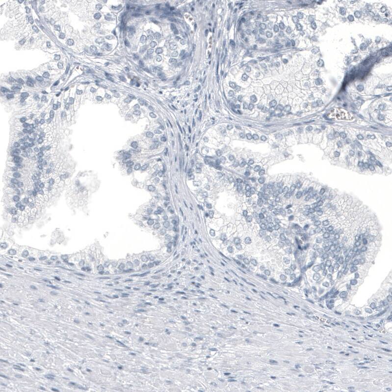 Immunohistochemistry-Paraffin: HO-1/HMOX1/HSP32 Antibody [NBP3-21199] -