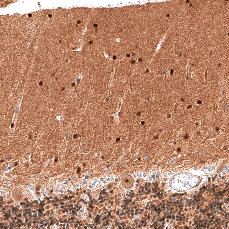 Immunohistochemistry-Paraffin: PTEN Antibody [NBP3-21200] -