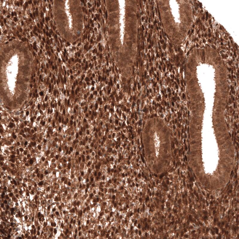 Immunohistochemistry-Paraffin: PTEN Antibody [NBP3-21200] -