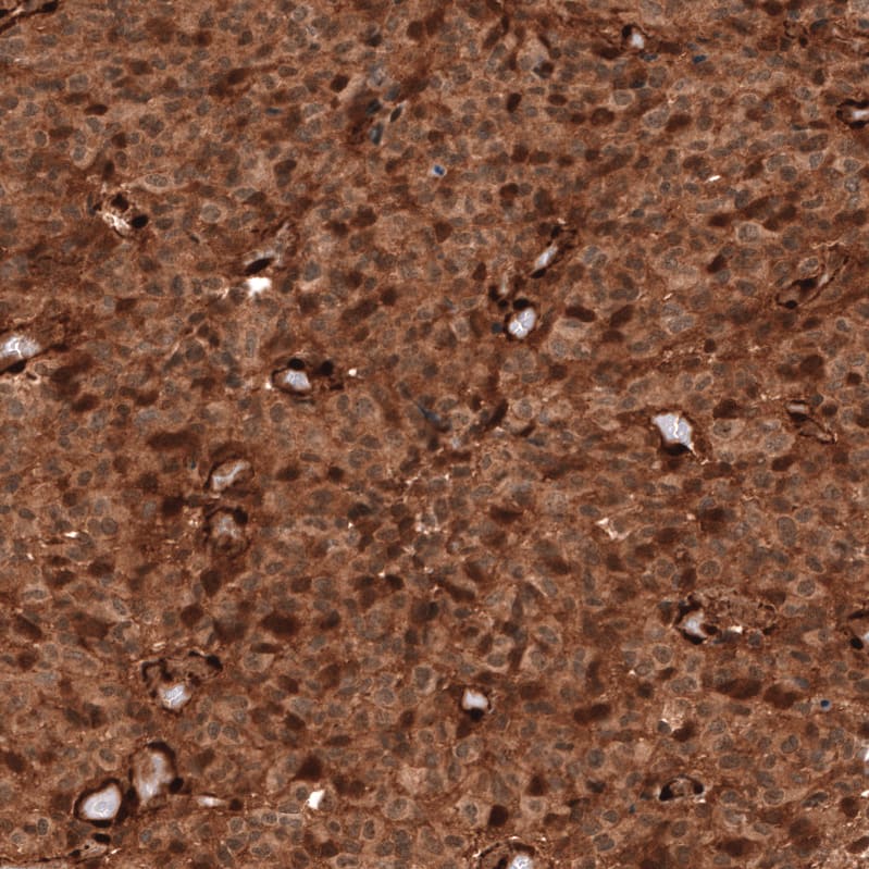 Immunohistochemistry-Paraffin: PTEN Antibody [NBP3-21200] -