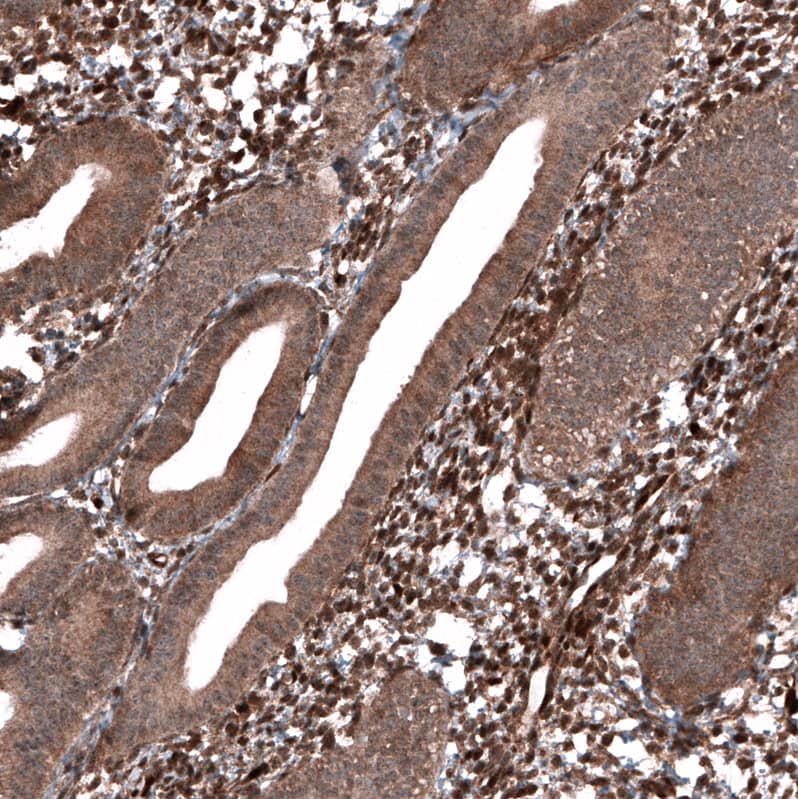 Immunohistochemistry-Paraffin: PTEN Antibody [NBP3-21201] -