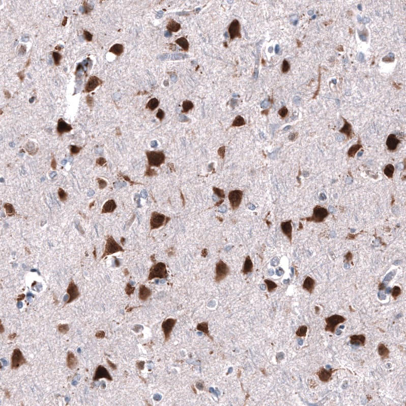 Immunohistochemistry-Paraffin: RBFOX3/NeuN Antibody [NBP3-21203] -