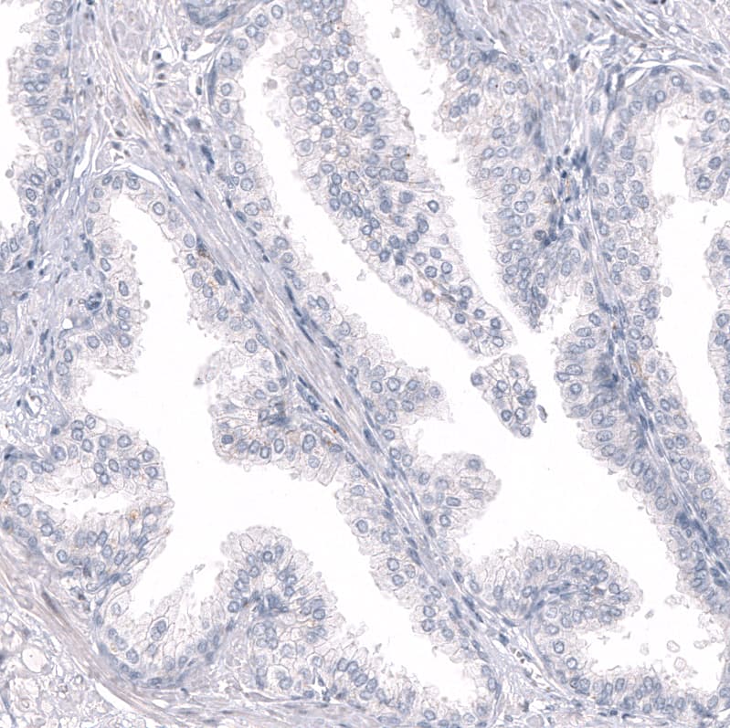 Immunohistochemistry-Paraffin: RBFOX3/NeuN Antibody [NBP3-21203] -