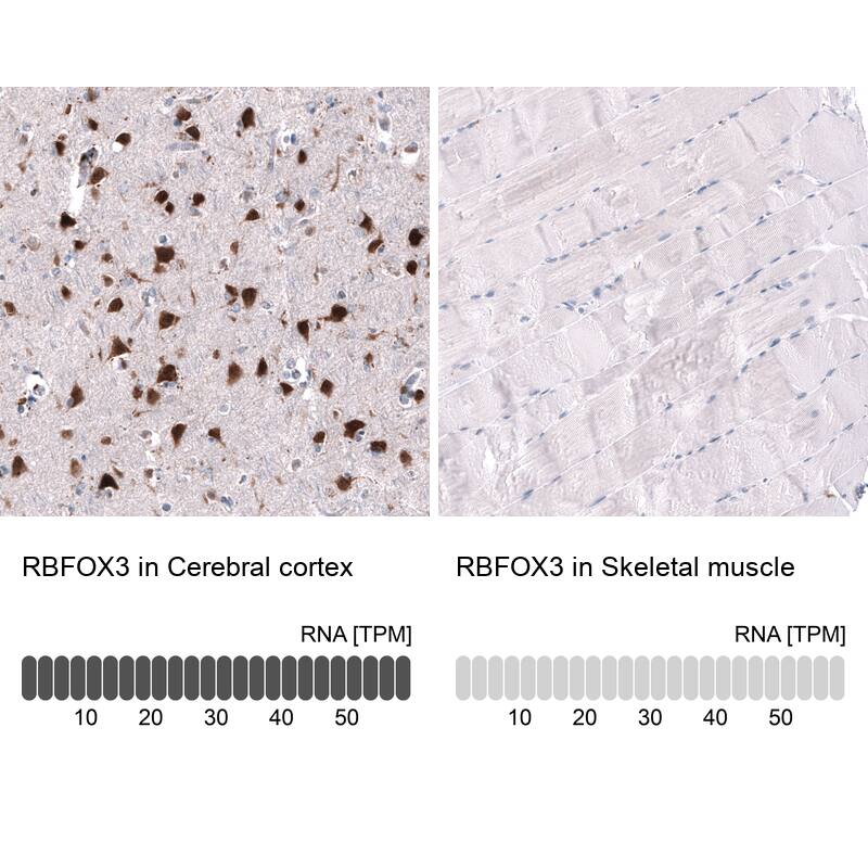 Immunohistochemistry-Paraffin: RBFOX3/NeuN Antibody [NBP3-21203] -