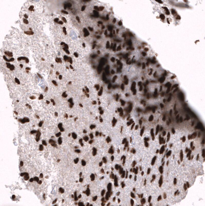 Immunohistochemistry-Paraffin: EZH2/KMT6 Antibody [NBP3-21204] -